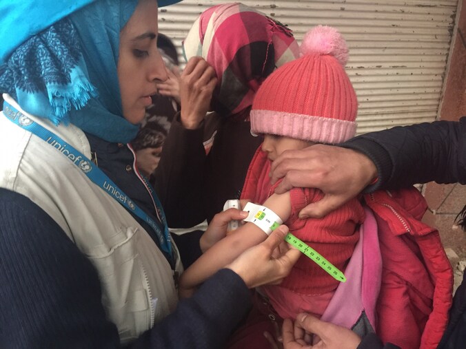 Unicef heeft beelden naar buiten gebracht van de ondervoede kinderen in Madaya.
