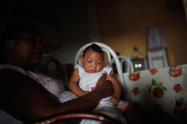 De drie maanden oude Alice Vitoria Gomes Bezerra zou geboren zijn met een schedelafwijking ten gevolge van het zikavirus.