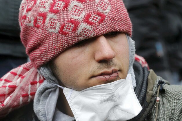 Een Iraanse migrant heeft zijn lippen dichtgenaaid ten teken van hongerstakuing tegen de ontruiming van de 'jungle' in Calais.