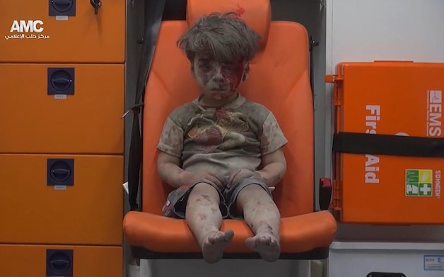 Deze foto van de gewonde vijfjarige Omran Daqneesh werd volgens president Assad vervalst.