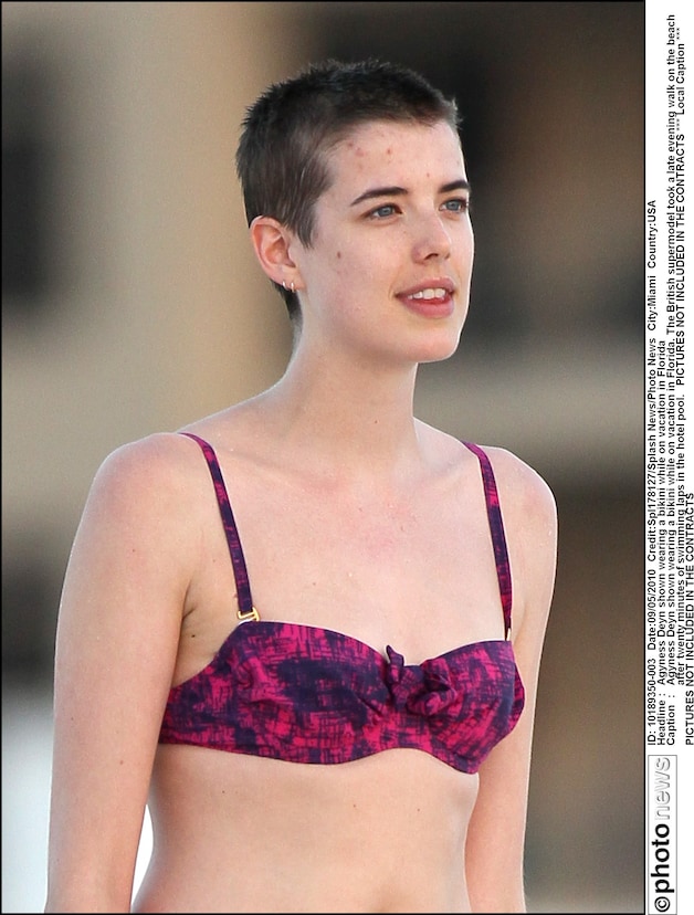 Agyness Deyn werd speciaal om haar korte lokken aangenomen door bekende modehuizen.