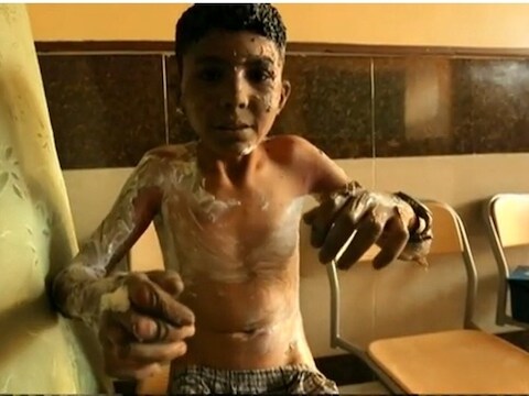 Een screenshot van de BBC-beelden na een brandbom op een Syrische speelplaats.