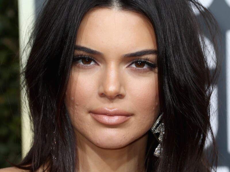 Kendall Jenner vol acne naar de Golden Globes: "Laat zoiets je niet tegenhouden" 
