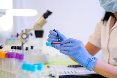 Doorbraak in onderzoek naar pancreaskanker dankzij
