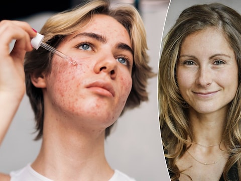 Onder meer Laura Vandenbosch, prof communicatiewetenschappen, legt uit waarom steeds meer jonge vrouwen een slechte relatie met skincare hebben.