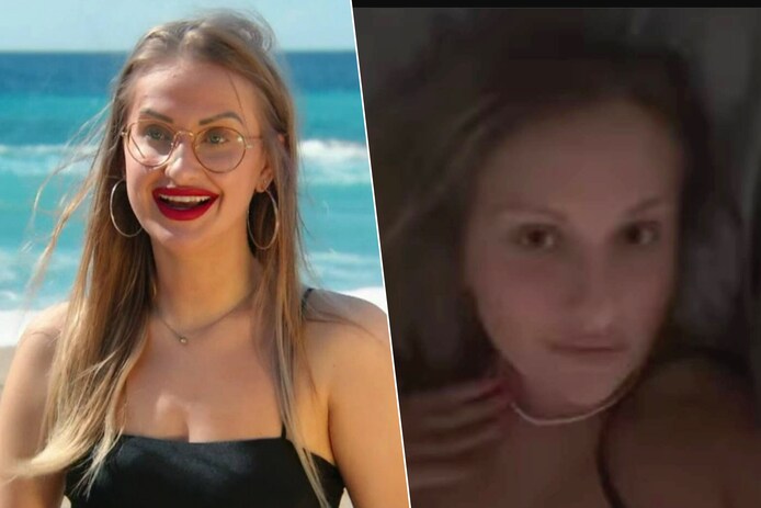 Realityster Imke Roose laat haar lipfillers verwijderen: “Zoveel beter ...