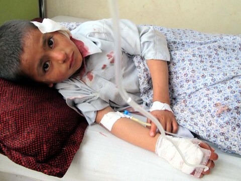 Een gewonde jongen wordt verzorgd na een aanslag in Kunduz dit weekend, die zeker acht burgers doodde en er 18 verwondde.