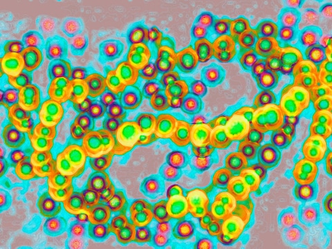 TSS wordt onder meer veroorzaakt door streptococcus pyogenes, een Groep-A-streptokok, die ook ‘vleesetende bacterie’ wordt genoemd.