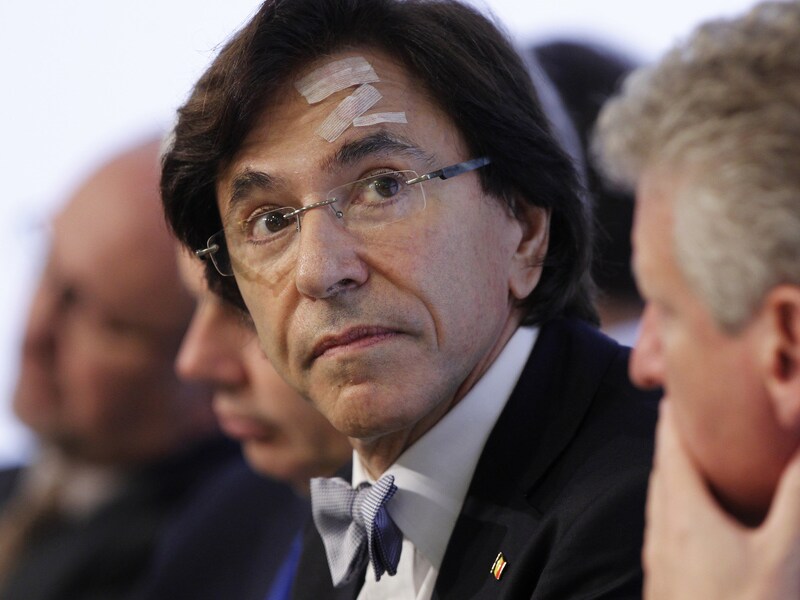 Premier Elio Di Rupo, gehavend na een val afgelopen weekend.