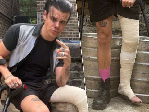 Yungblud is gewond aan zijn been. 